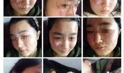 伤痕最新爆料视频,最新视频揭秘惊人内幕